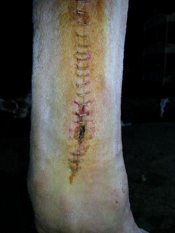 Blottat och infekterat...