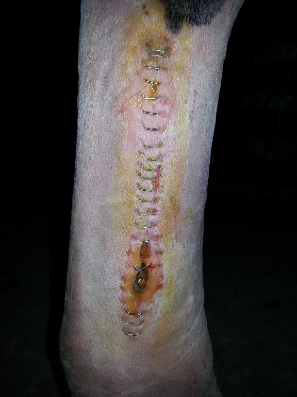 Blottat och infekterat...